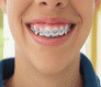 Dentes com  - aparelho dica e cuidados